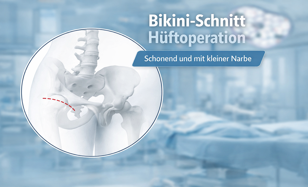 Bikini schnitt hueftoperation